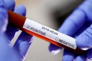 "சென்னையின் இந்த ஒரு மண்டலத்தில் மட்டும் 1,112 பேருக்கு கொரோனா!".. இந்தியாவில் '90 ஆயிரத்தை' தாண்டிய 'எண்ணிக்கை'!