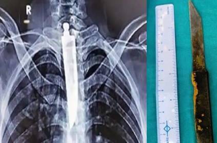 Bhopal man swallows a 14 cm long knife removes successfully