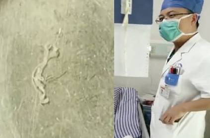 China youth 5 inch long worm brain 17 years doctors removed