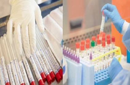 icmr nods for indias first covid19 rapid test kit oscar medicare