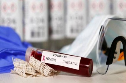 India Difficult To Predict Coronavirus Peak Says ICMR