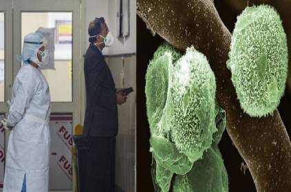 india first person infected green fungus in India was found