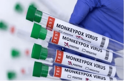 Kerala reports India third monkeypox case who returned from UAE