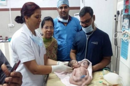Woman gives birth babyboy with 2 heads 3 hands in MP