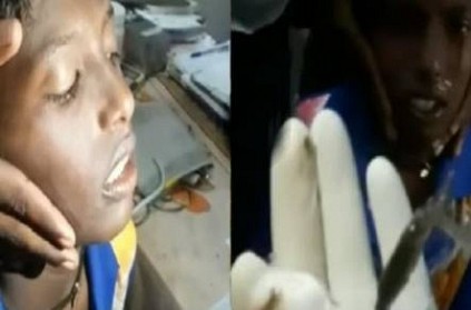 Jilebi fish sneaked into boy\'s nose while bathing in well