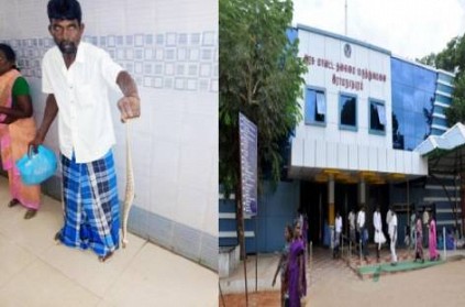 ramnad man takes dead snake to hospital after it bites him