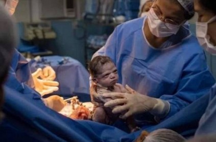 A stunning photo of a Newborn baby viral on social media
