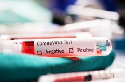 Afghanistan Could Have One Of Highest Coronavirus Infection Rates