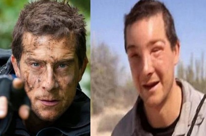 Bear Grylls saved by medics after bee sting knockout