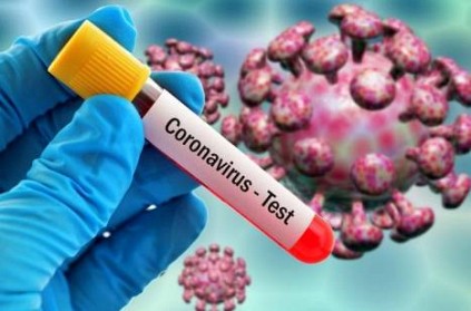 China makes a request to India regarding Covid-19 Virus