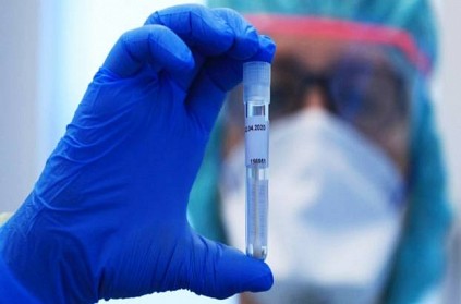 Coronavirus Pandemic Started Between October 6 - December 11 2019