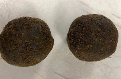 Cow Dung Cakes Found Inside Indian Passenger\'s Bag by US Customs