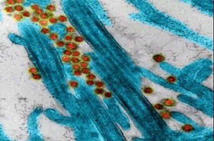 France revealed the image of coronavirus sarscov2 virus