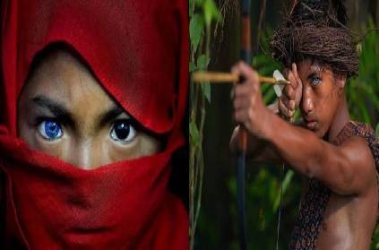 indonesia tribes with blue eyes gene mutation rare condition