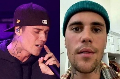 Justin bieber says his face partly paralysed fans sad