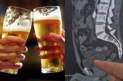 Man holds urine for 18 hours after drinking 10 beers