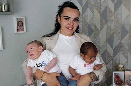 mum stunned after twins born with different skin tones