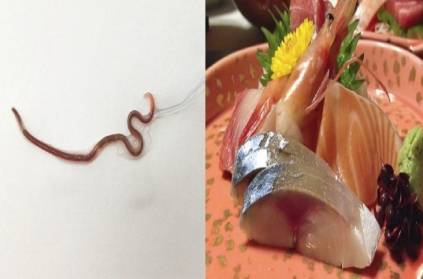tokyo complain throat pain doctor find black moving worm inside