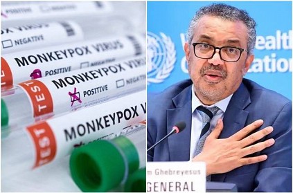 WHO outlines five preventive measures to stop monkeypox transmission