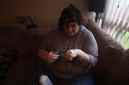 Woman Who is Addicted to EATING Talcum Powder for 15 Years
