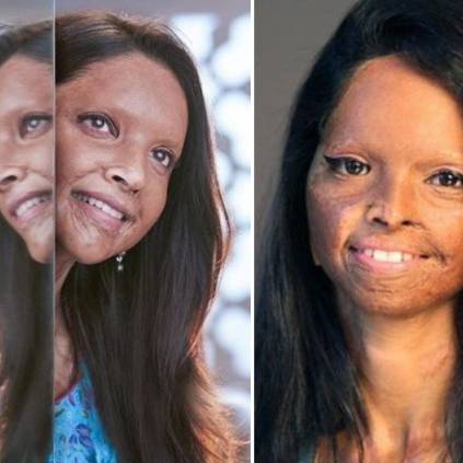 Deepika Padukone reveals her look in Chhapaak, story of acid attack survivor Laxmi Agarwal